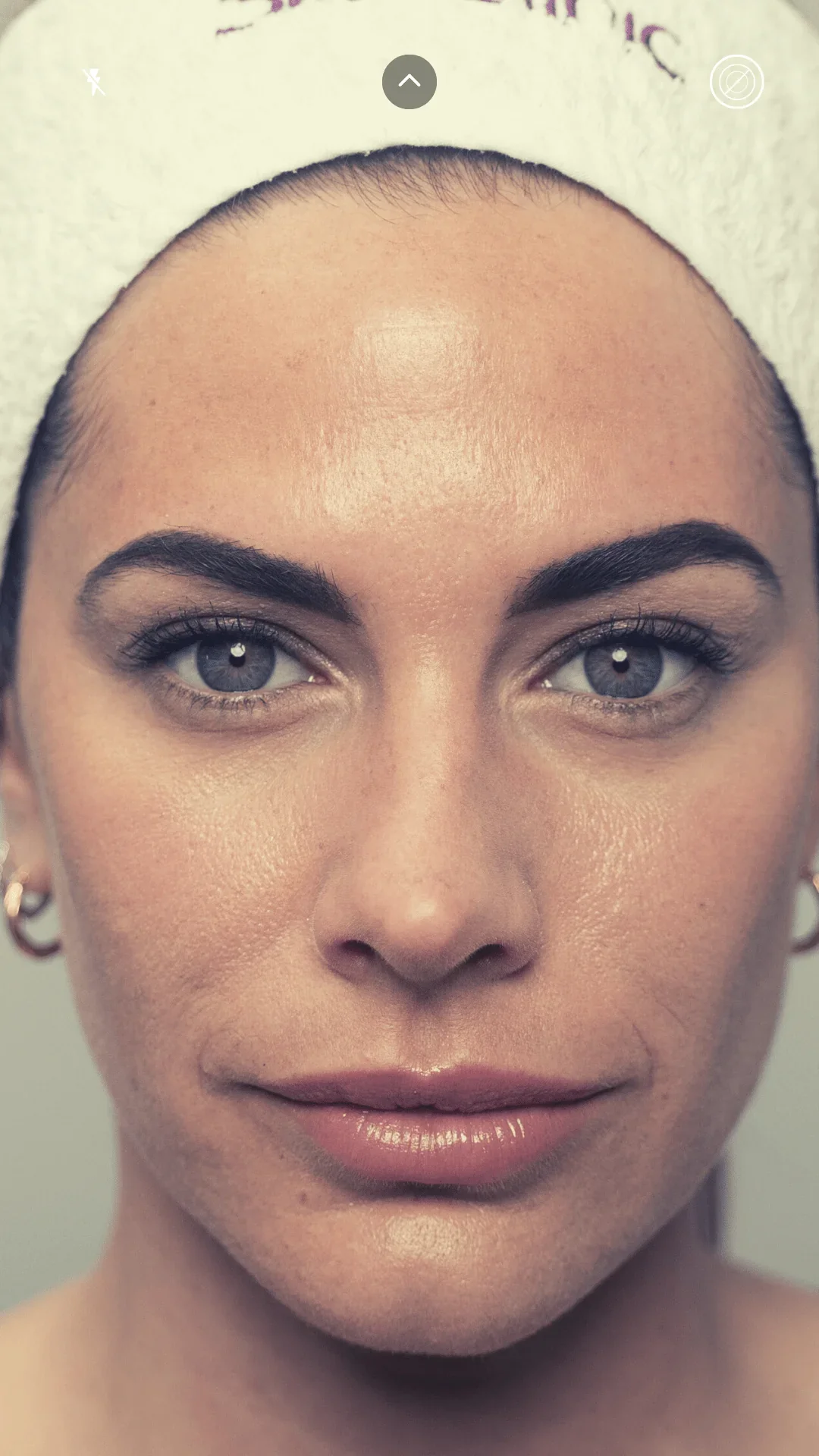 Ultherapy Prime